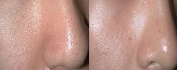 Before & After